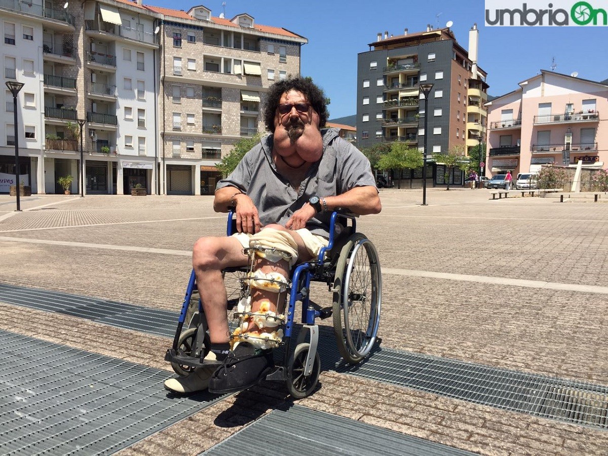 Terni: «Io, disabile privato dei diritti»