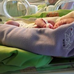 Complessa Tac all’aorta su neonato di due giorni conferma rara malformazione